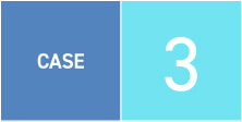 CASE3